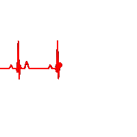 Heartbeat ECG